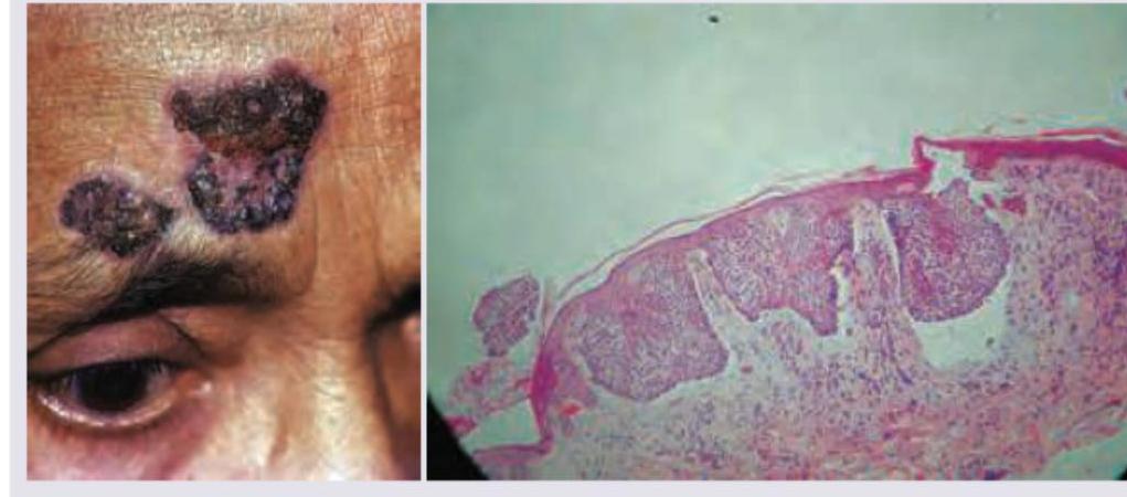 Image for question 213