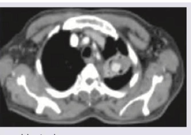 Image for question 75