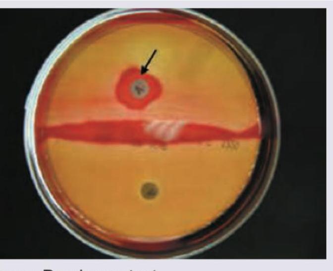 Image for question 118