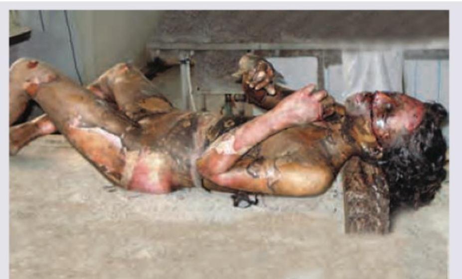 Image for question 9