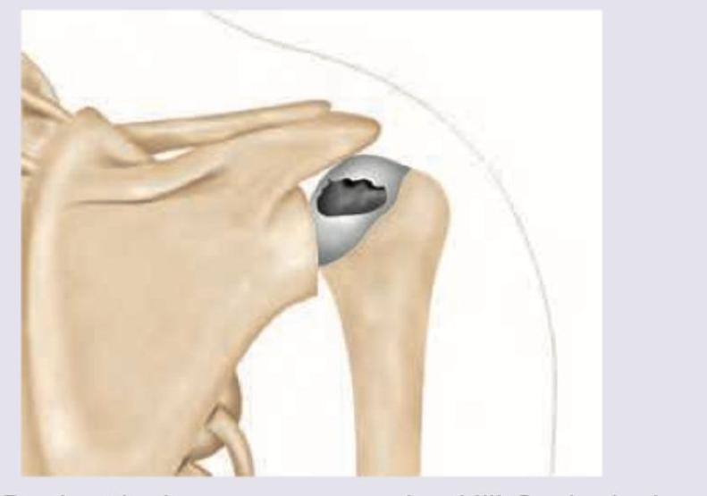 Image for question 920