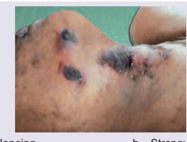 Image for question 212