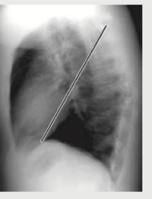 Image for question 146