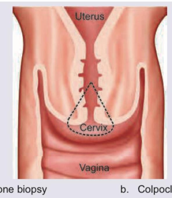 Image for question 914