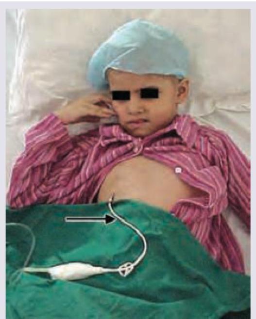 Image for question 151