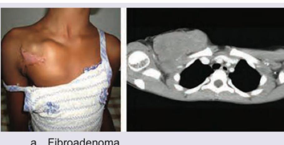 Image for question 150