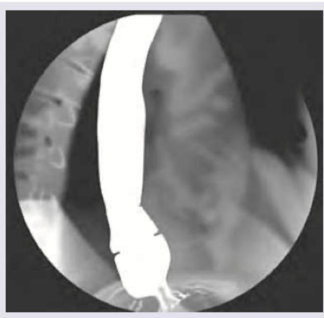 Image for question 171