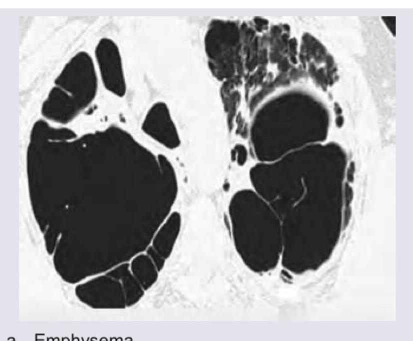 Image for question 370