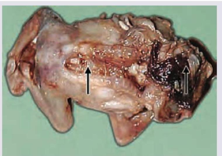 Image for question 199