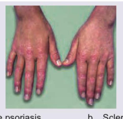 Image for question 89