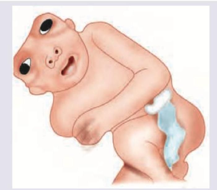 Image for question 198