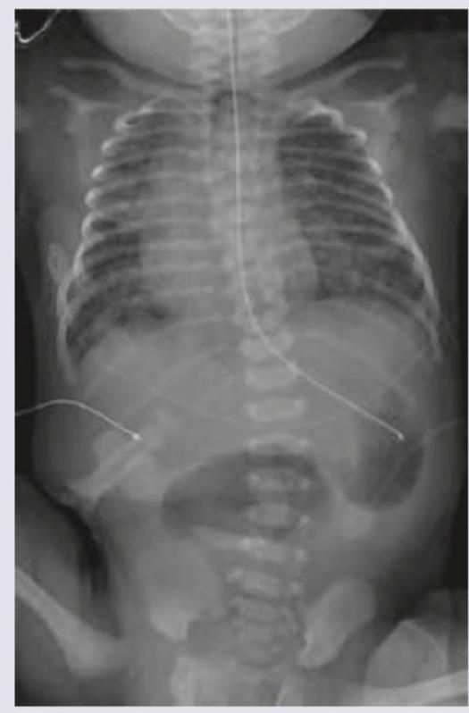 Image for question 253