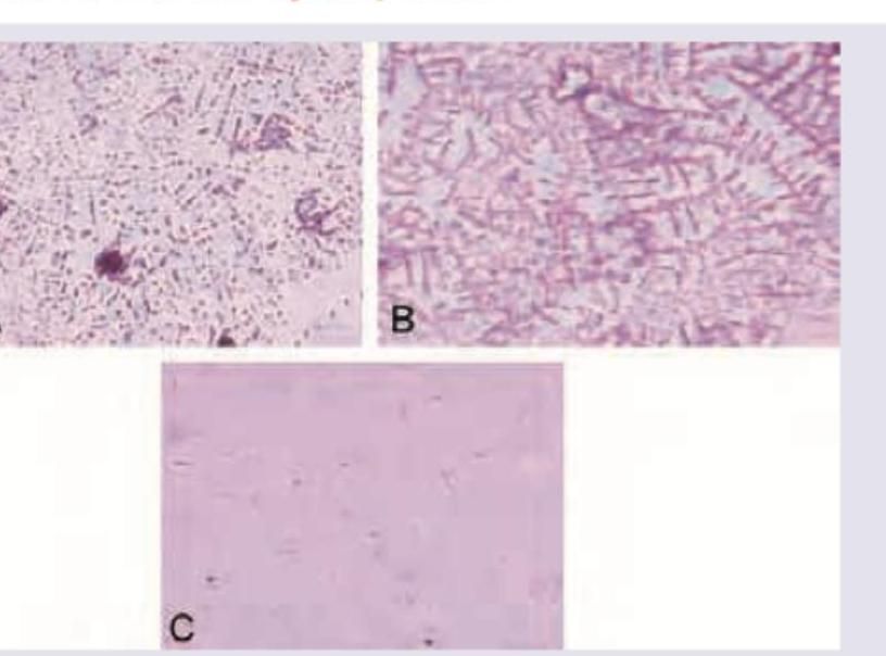 Image for question 300