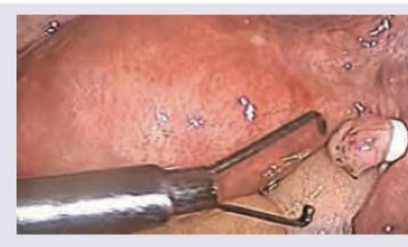 Image for question 563