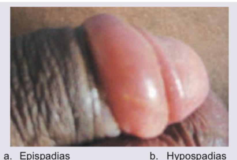 Image for question 698