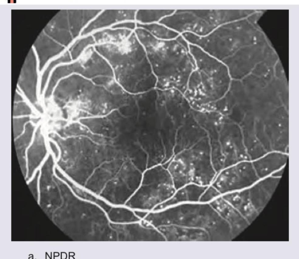 Image for question 2