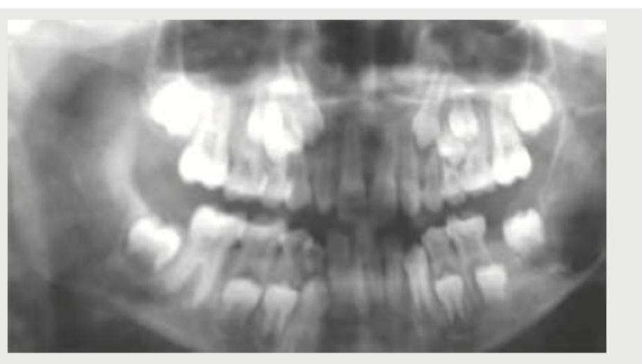 Image for question 137