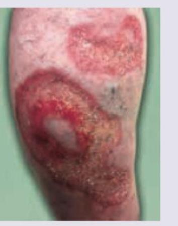 Image for question 255