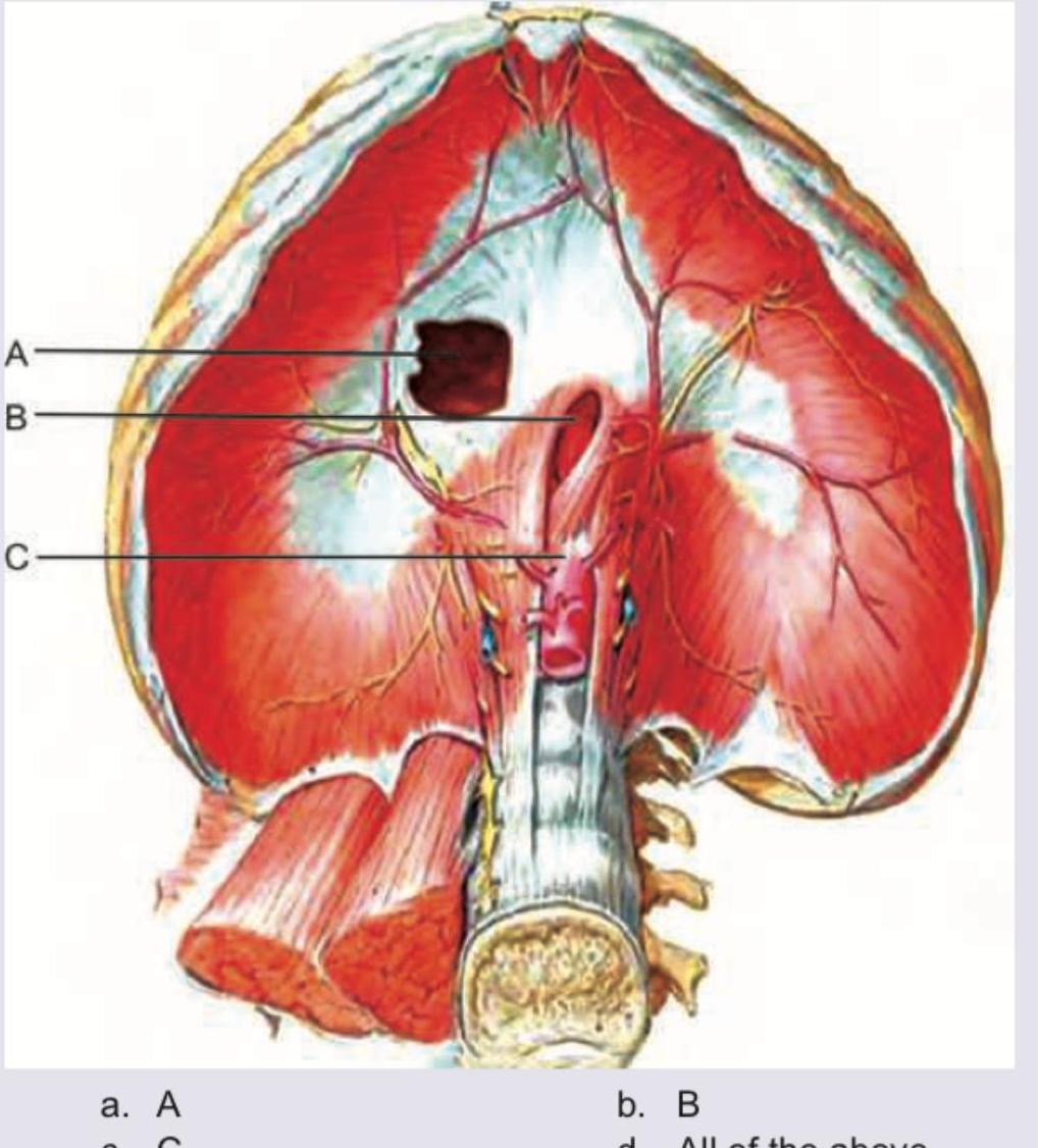 Image for question 597