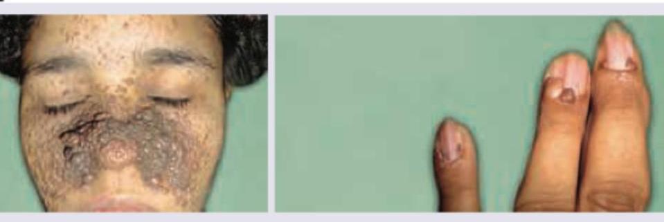 Image for question 209