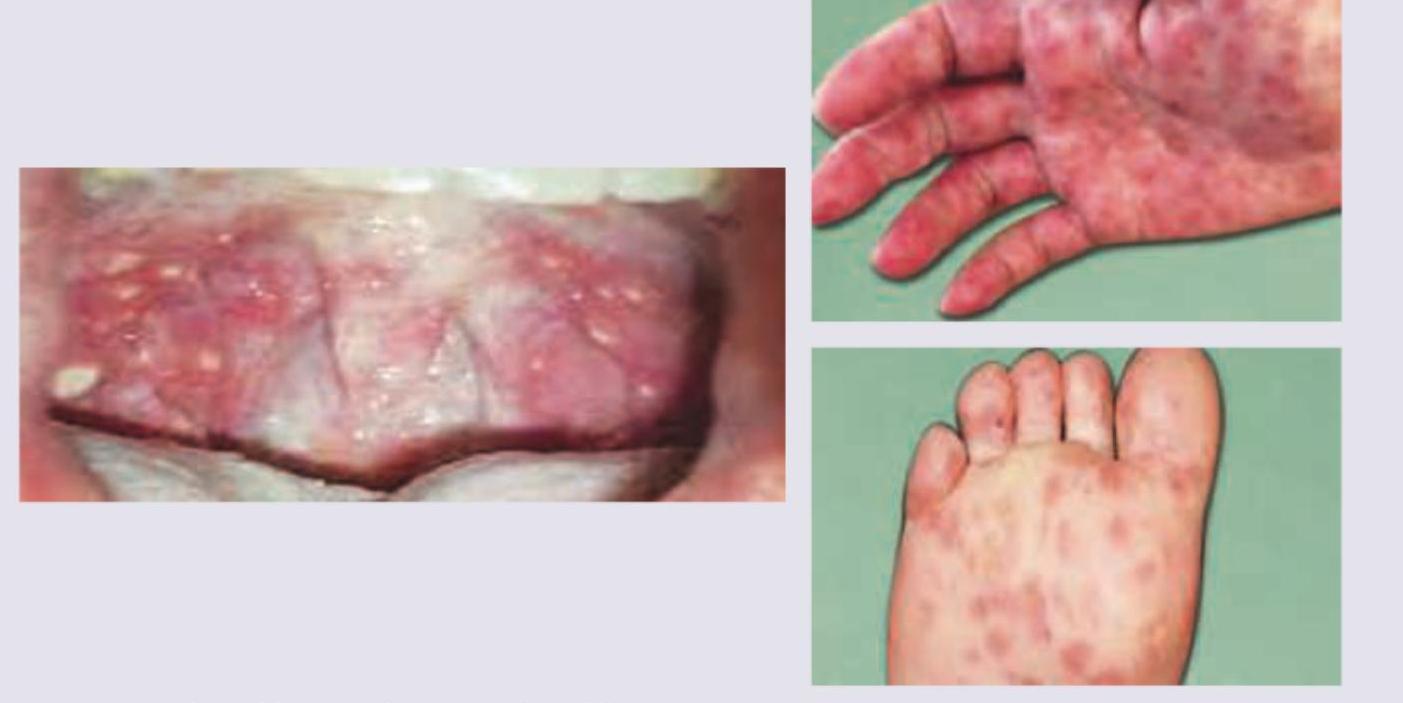 Image for question 76