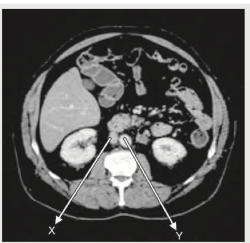 Image for question 557