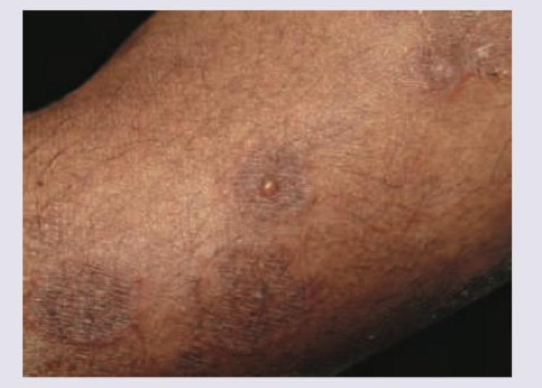 Image for question 82