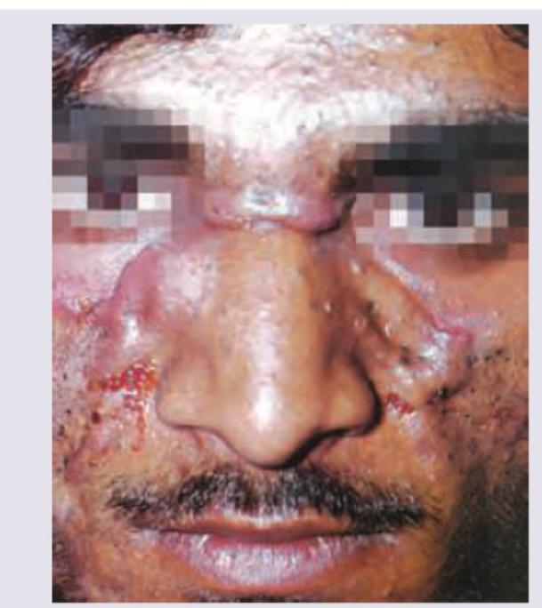 Image for question 56