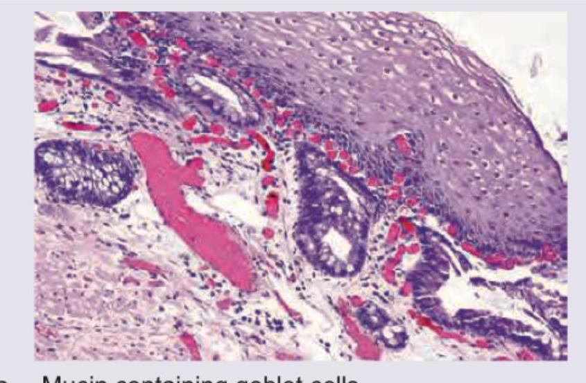 Image for question 461