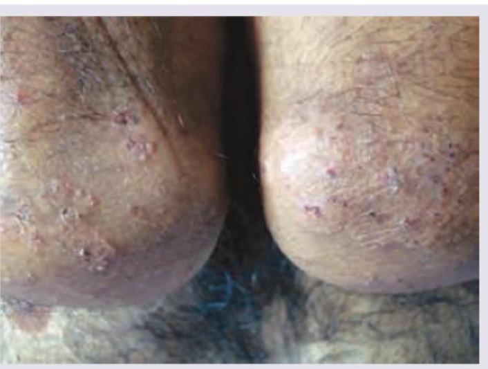 Image for question 160