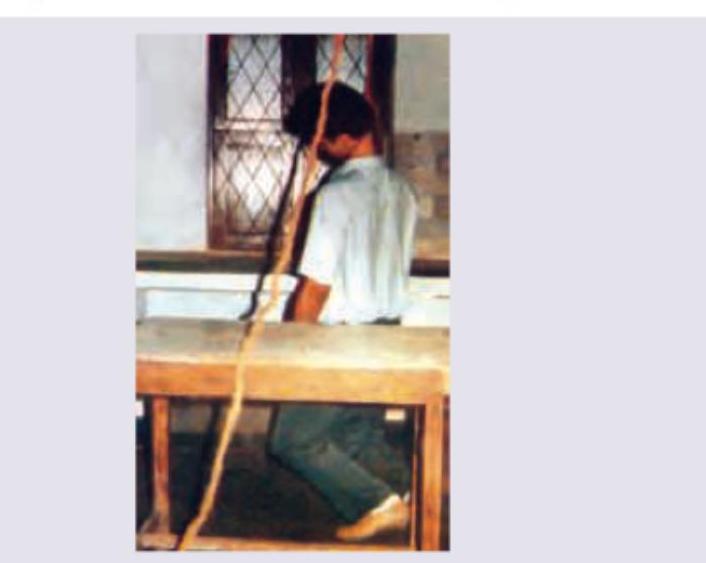 Image for question 214