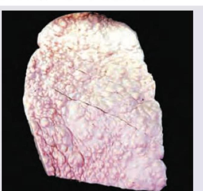 Image for question 348