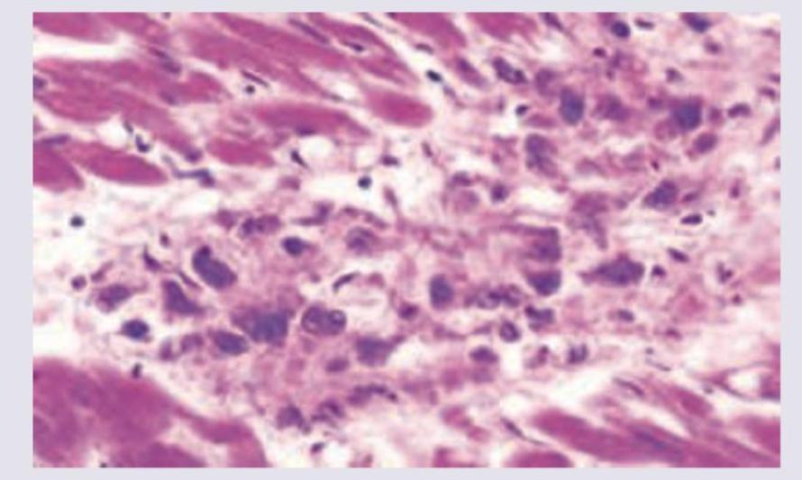 Image for question 200