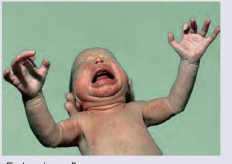 Image for question 646