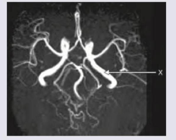 Image for question 122