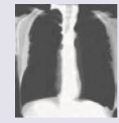 Image for question 731