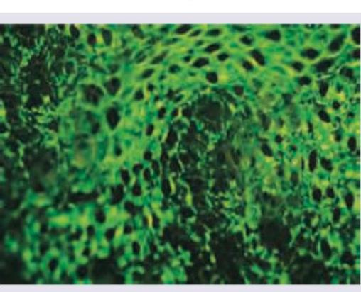 Image for question 162