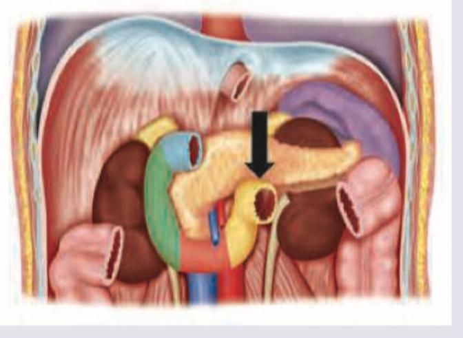 Image for question 711