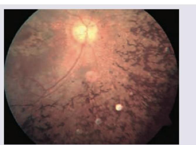 Image for question 444