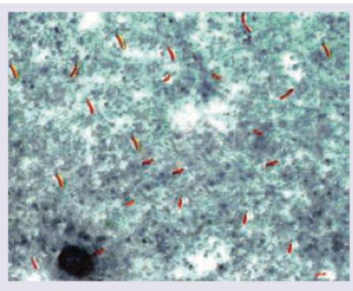 Image for question 2054