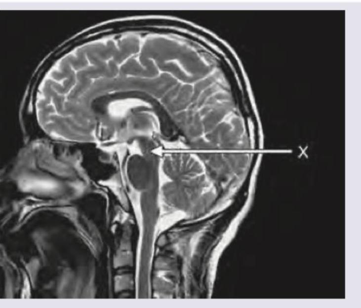 Image for question 362