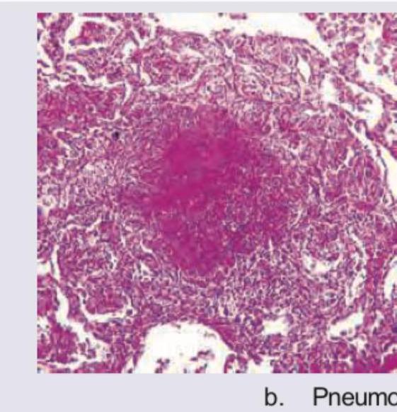 Image for question 416