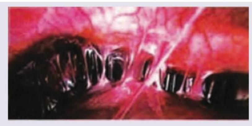 Image for question 77