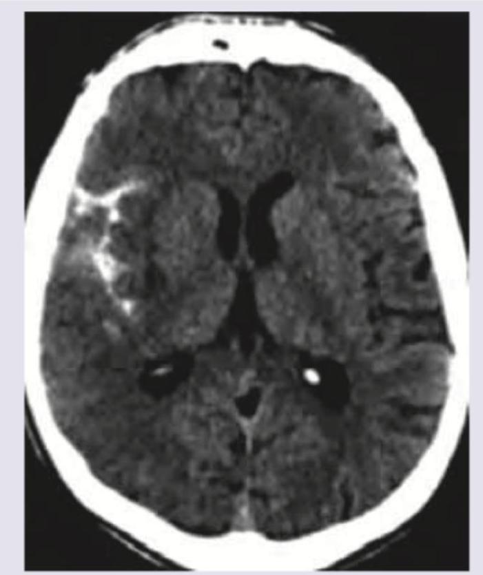 Image for question 3