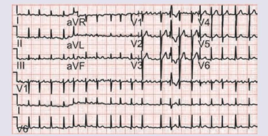 Image for question 959