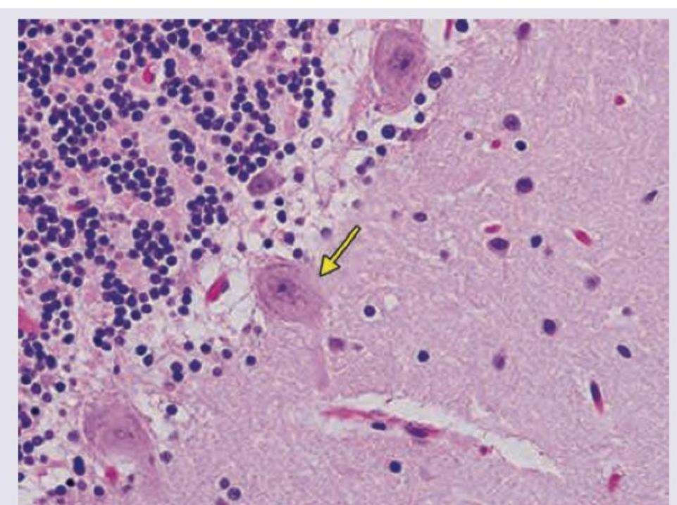 Image for question 165