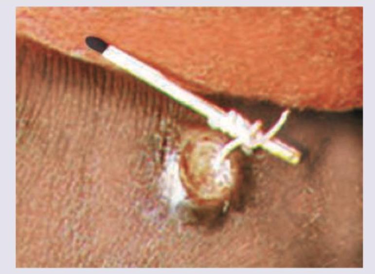 Image for question 19