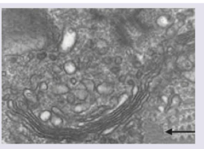 Image for question 157