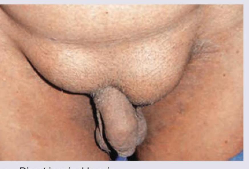 Image for question 779