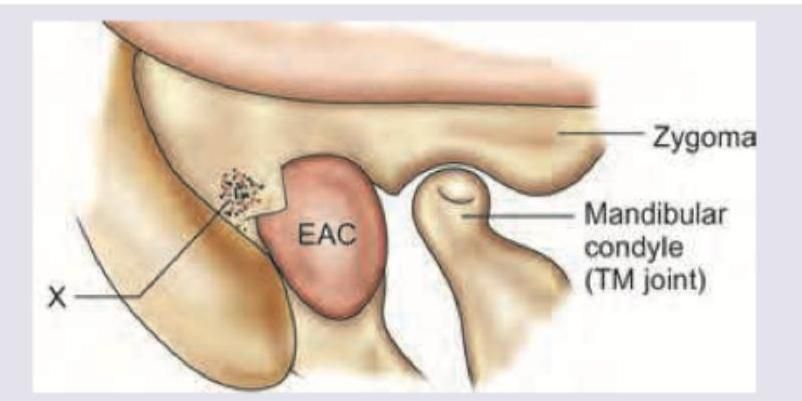 Image for question 210
